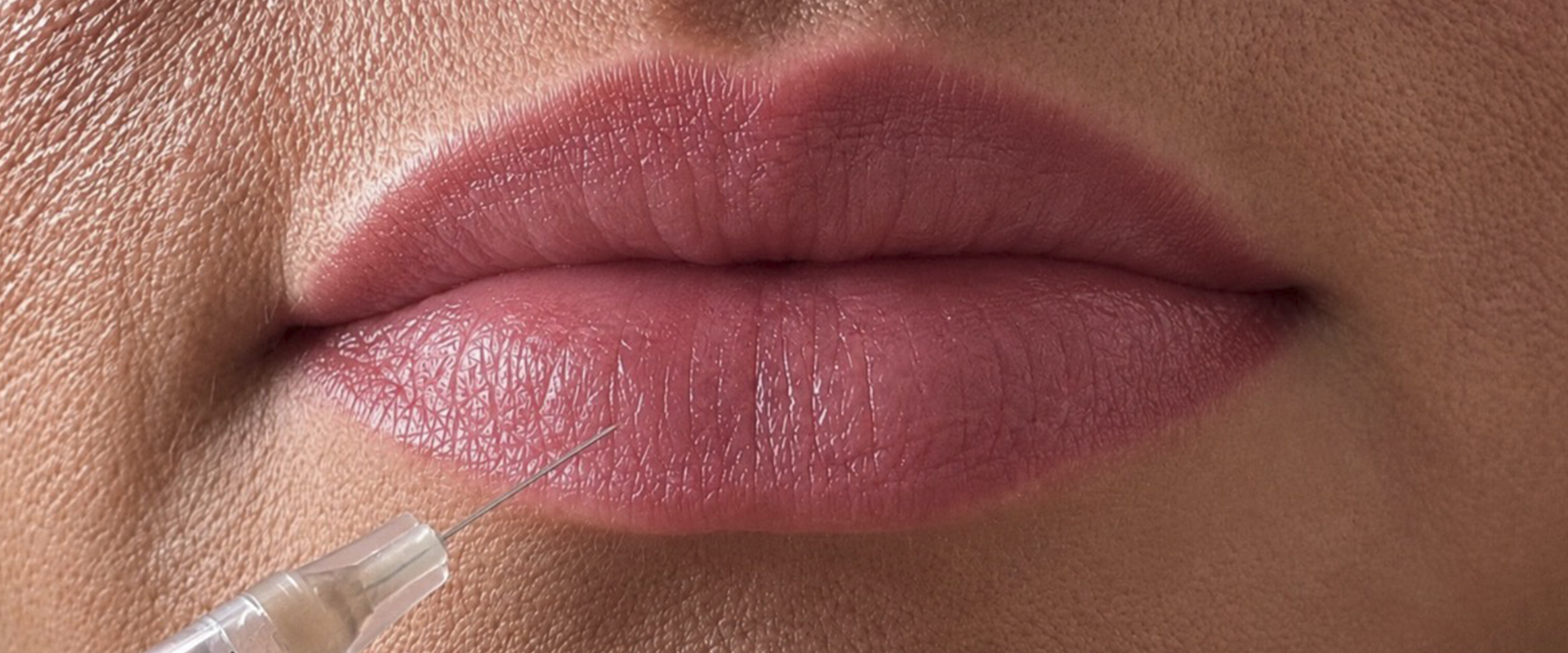 Lip Fillers and Dermal Fillers Botox from Gentle Touch in Marlborough