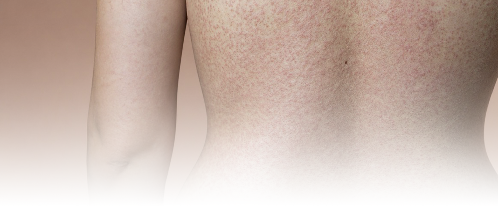Private Dermatology Consultations and Treatments from Gentle Touch in Marlborough